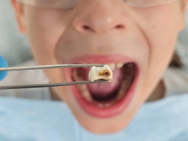 Best Same-Day Emergency Dental Services in Sparta, IL